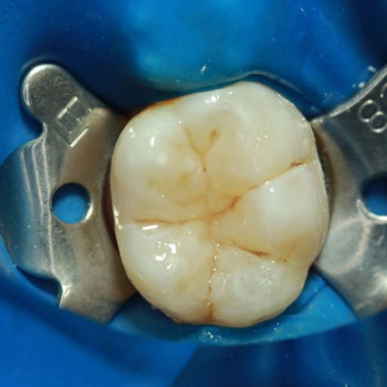 Максим Мосейчук, Винница Фото - 6