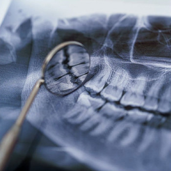 Фото з портфоліо фахівця Ліана Голуб (стоматолог, Вінниця)