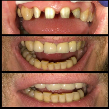 Віталій Чайка, Вінниця Фото - 5