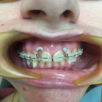 Медиан, Одесса Фото - 5