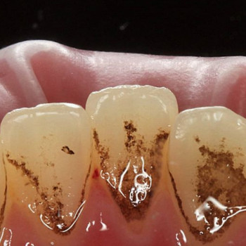 Юлия Краснянская, Винница Фото - 6