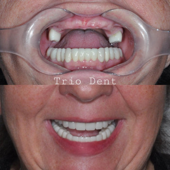 TrioDent, Одесса Фото - 5