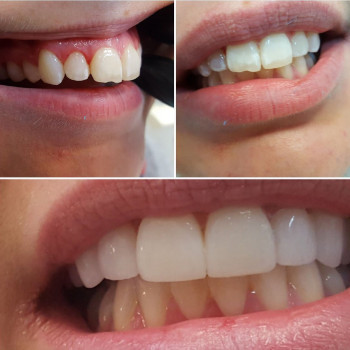 Ехсеlline Medical Corp., Одеса Фото - 5