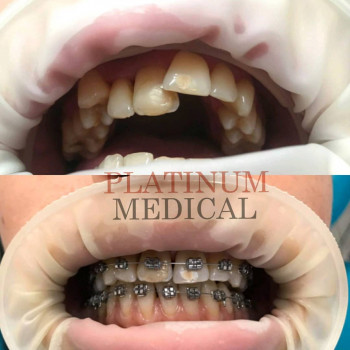 Платинум, Львов Фото - 5