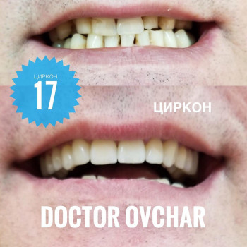 Стоматологічна клініка Овчара, Львов Фото - 3