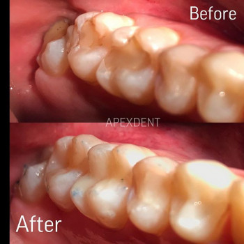 Apex Dent, Львов Фото - 6