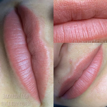 Татуаж губ
 
   