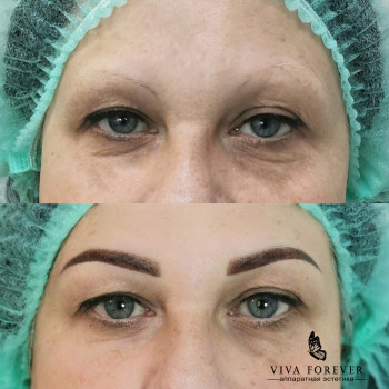 Очень важно подобрать правильную форму!