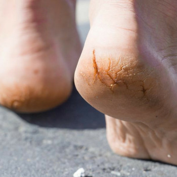 Педикюр, покрытие
                    Майстер манікюру Татьяна Київ