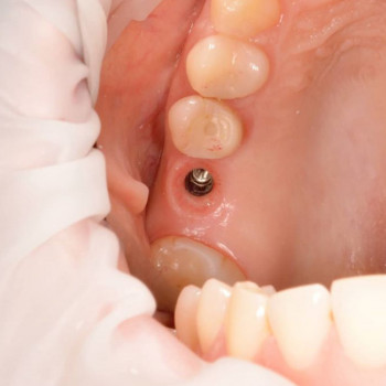 Євген Никодюк, Житомир Фото - 6