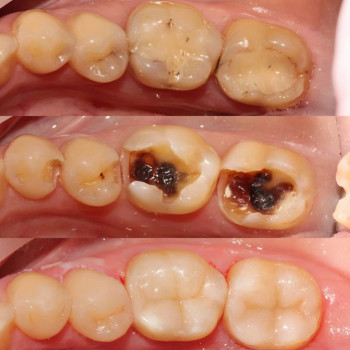 Максим Сердийчук, Житомир Фото - 6