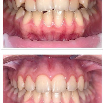 Сергій Шевчук, Житомир Фото - 5