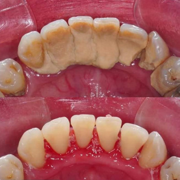 Зинаида Плохотюк, Житомир Фото - 5