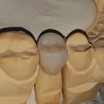 Андрей Мороз, Днепр Фото - 5