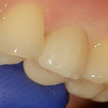 Андрей Мороз, Днепр Фото - 6