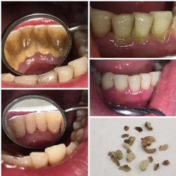 Михайло Місарош, Запорожье Фото - 5