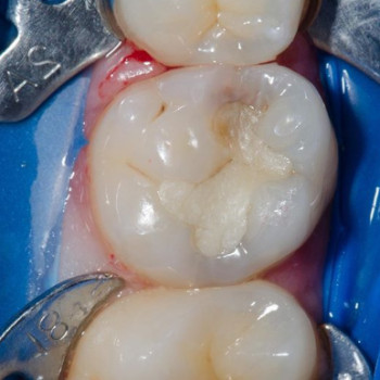 Светлана Фесенко, Запорожье Фото - 6