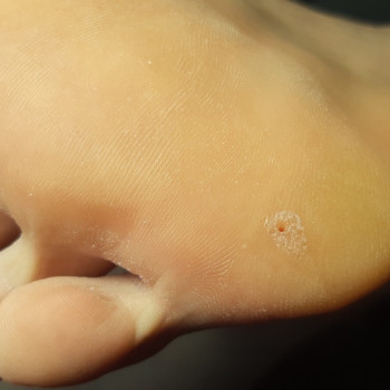 Педикюр, покрытие
                    Майстер манікюру Татьяна Київ