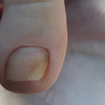 Педикюр, покрытие
                    Майстер манікюру Татьяна Київ