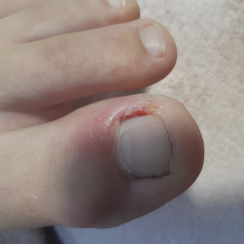 Педикюр, покрытие
                    Майстер манікюру Татьяна Київ