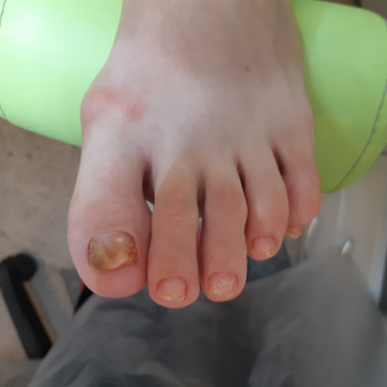 Педикюр, покрытие
                    Майстер манікюру Татьяна Київ