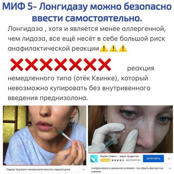 Розчинення філера лонгідазою
                    Салон красоты Beauty Line Запорожье