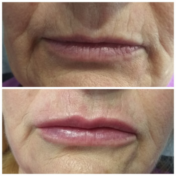 Тетяна Вінник, Вінниця Фото - 24