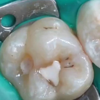 Руслан Глушко, Запорожье Фото - 5