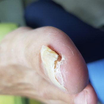 Іванна Остасюк, Львов Фото - 18