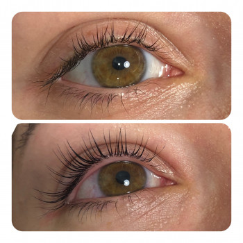 Ламінування вій+філлер
                    Бровист Наталя Львов