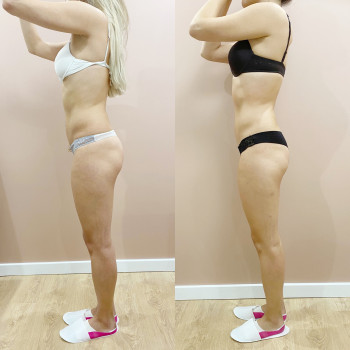 Фото з портфоліо майстра Анастасія Макарова (масажист, Львів)