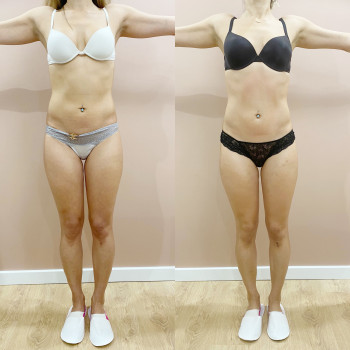 Фото з портфоліо майстра Анастасія Макарова (масажист, Львів)