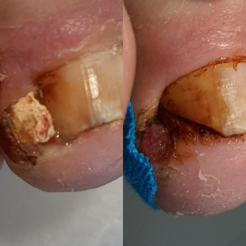 Тетяна Голікова, Запоріжжя Фото - 31