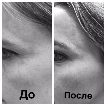 Симбиозный массаж лиц