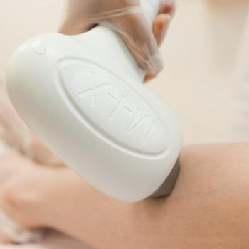 Laserhub, Днепр Фото - 5