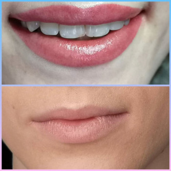 Зробити татуаж губ біля будинку Бровари