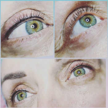 Зробити міжвійку очей біля будинку Бровари