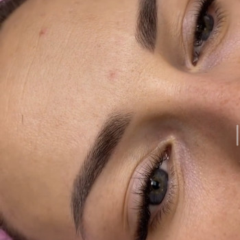 Зажившие бровки перед коррекцией