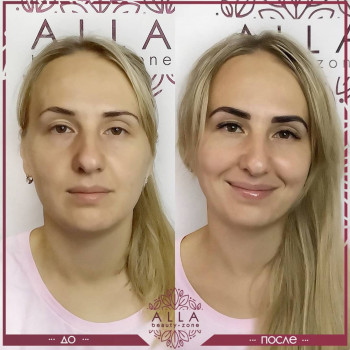 2д наращивание ресниц
                    Салон красоты ALLA beauty-zone Харьков