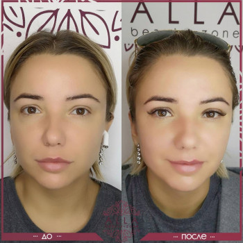2д наращивание ресниц
                    Салон красоты ALLA beauty-zone Харьков