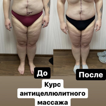 Beauty Spa, Запоріжжя Фото - 10