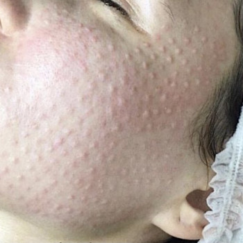 Фото с портфолио Марина Шамрай