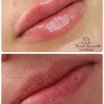 Наталья Еременко, Суми Фото - 9