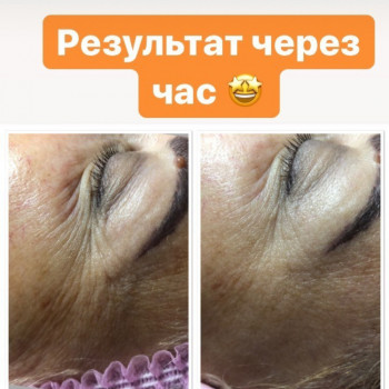 Studio Beauty Fox, Одесса Фото - 9