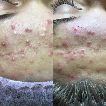 Анжеліка Мироненко, Київ Фото - 7