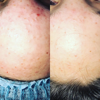 Анжеліка Мироненко, Київ Фото - 5