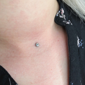 установка микродермала