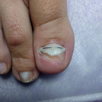 Наталья Николайчук, Миколаїв Фото - 8