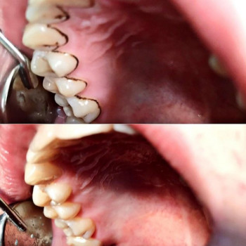 White and Happy, Вінниця Фото - 5