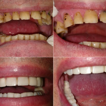 Лікорис, Вінниця Фото - 7